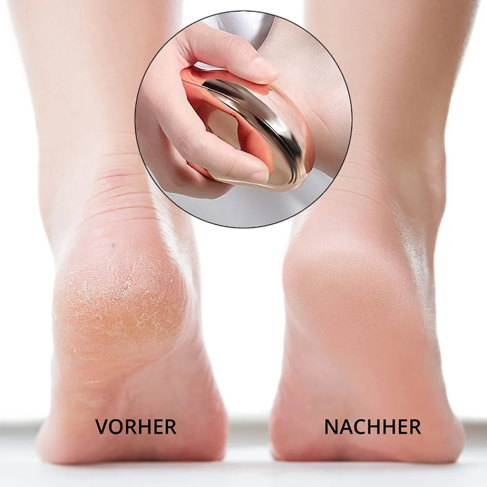 AILORIA Hand & Fuß|Doucette Pro Hornhautentferner Set Orange