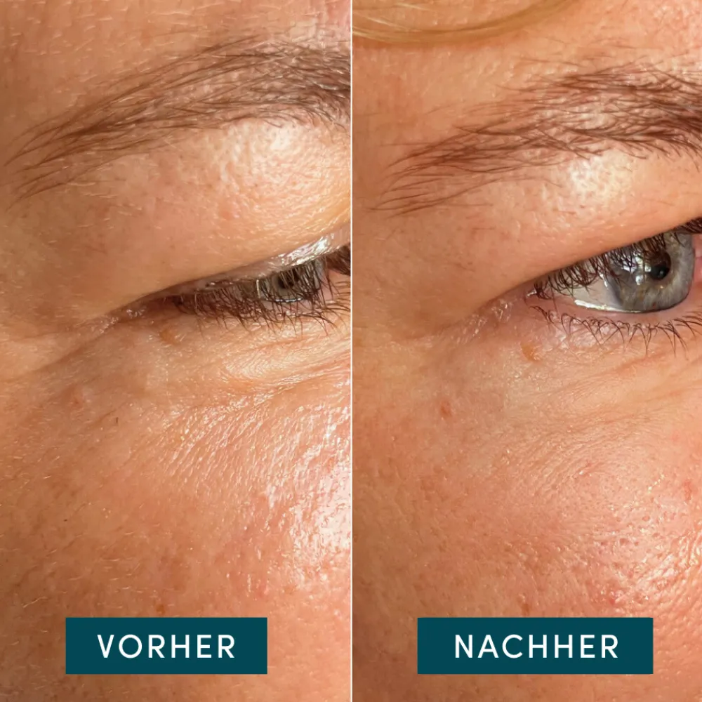 APRICOT Hautverjüngung|Gesicht^Eye & Temple Pads 2 Stück