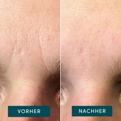 APRICOT Hautverjüngung|Gesicht|Gesicht Patches mit Panthenol 100 Stück