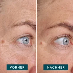 APRICOT Gesicht^Wiederverwendbare Augen-Schläfen Pads mit Ectoin