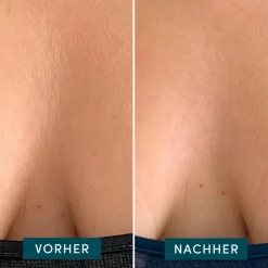 APRICOT Gesicht|Wiederverwendbares Dekolleté Pad mit Ectoin