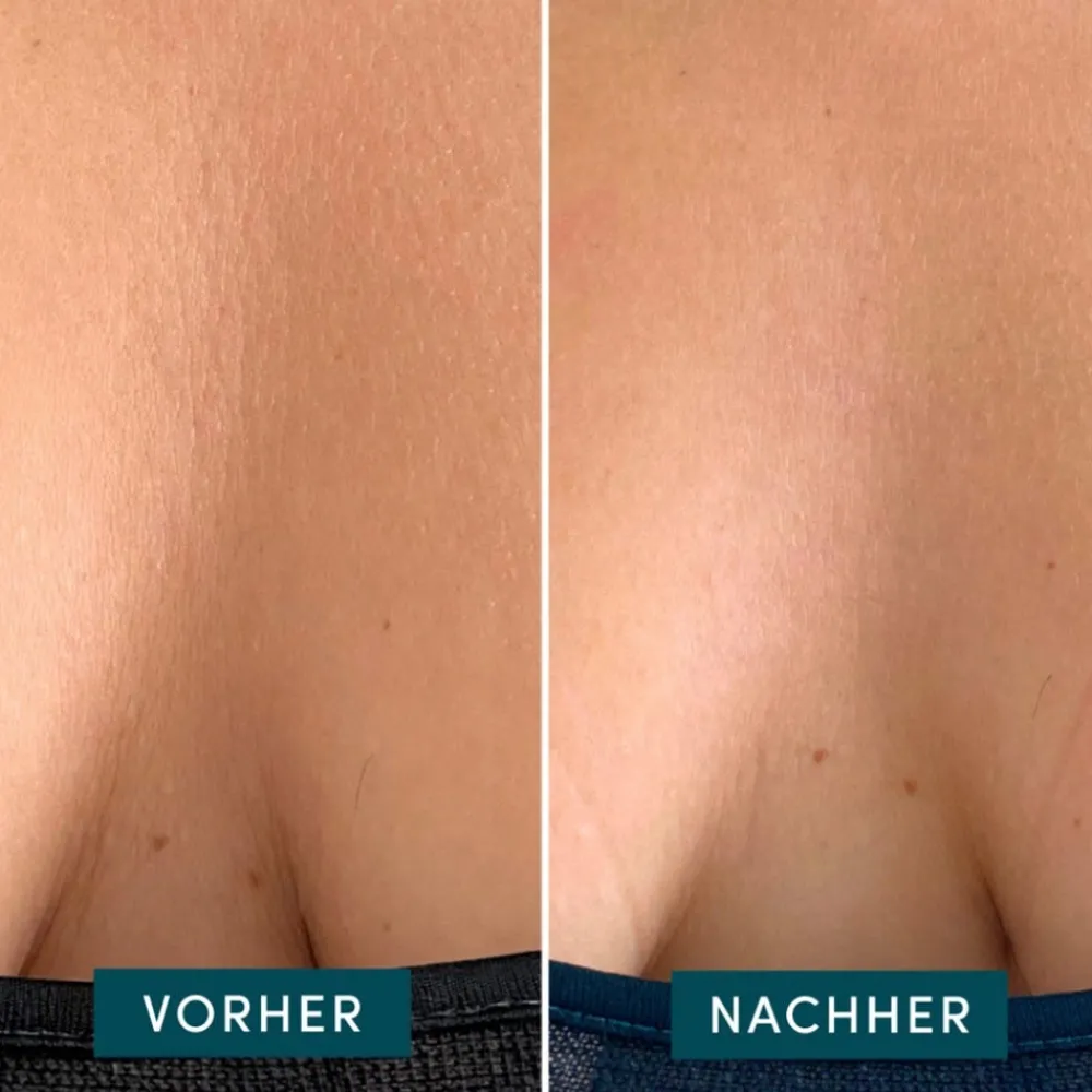 APRICOT Gesicht|Wiederverwendbares Dekolleté Pad mit Ectoin