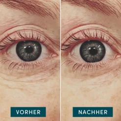 APRICOT Hautverjüngung|Gesicht^Wiederverwendbare Augen Pads mit Hyaluron