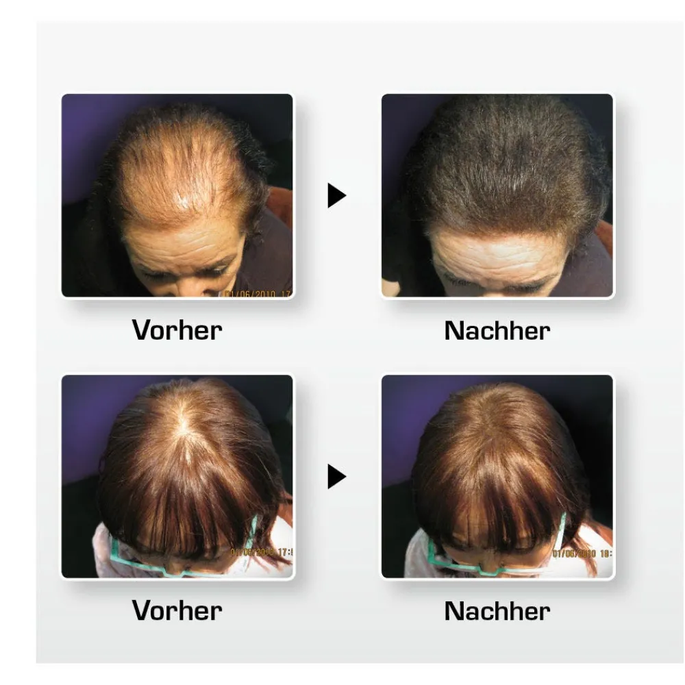 BioThik Kopfhautpflege|Haarverdichtung|Haaraufbau-Faser S4 hellbraun 25 g