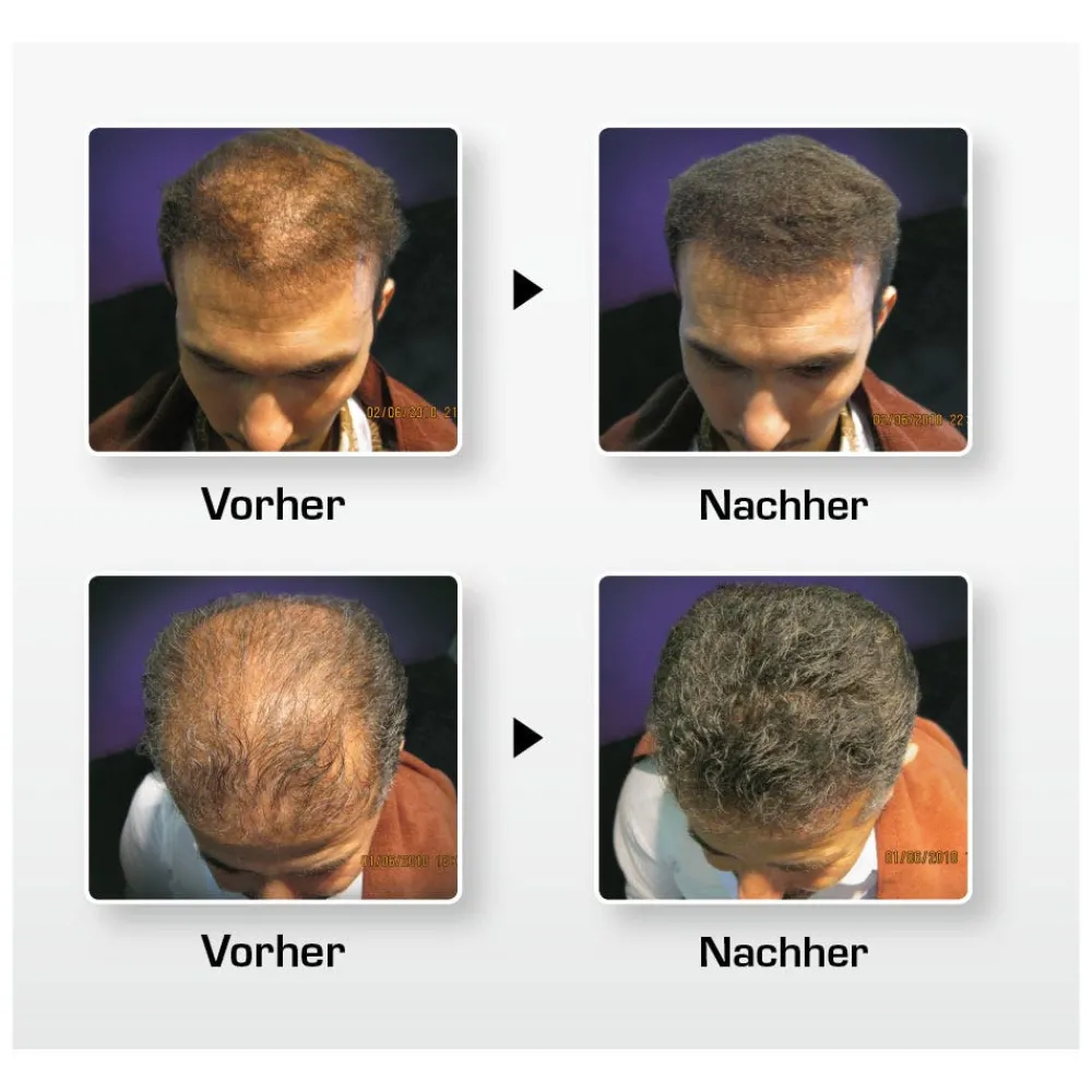 Haaraufbau-Faser S3 mittelbraun 15 g-BioThik Discount