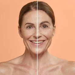 - Brow Lifting Starter Kit-Combinal Clearance