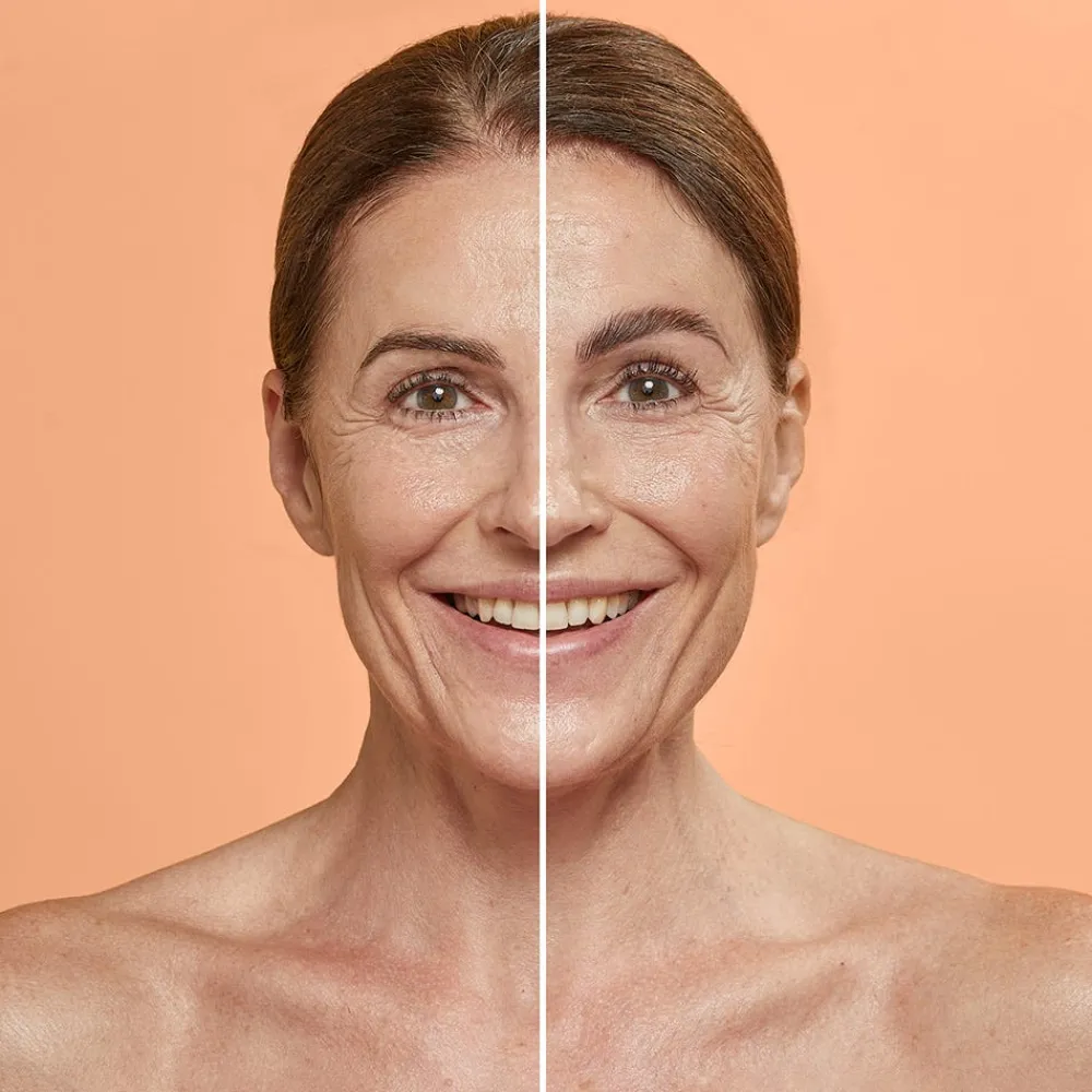 - Brow Lifting Starter Kit-Combinal Clearance