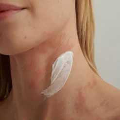 EXTRODERM Intensivcreme 50 ml-Dado Sens Clearance