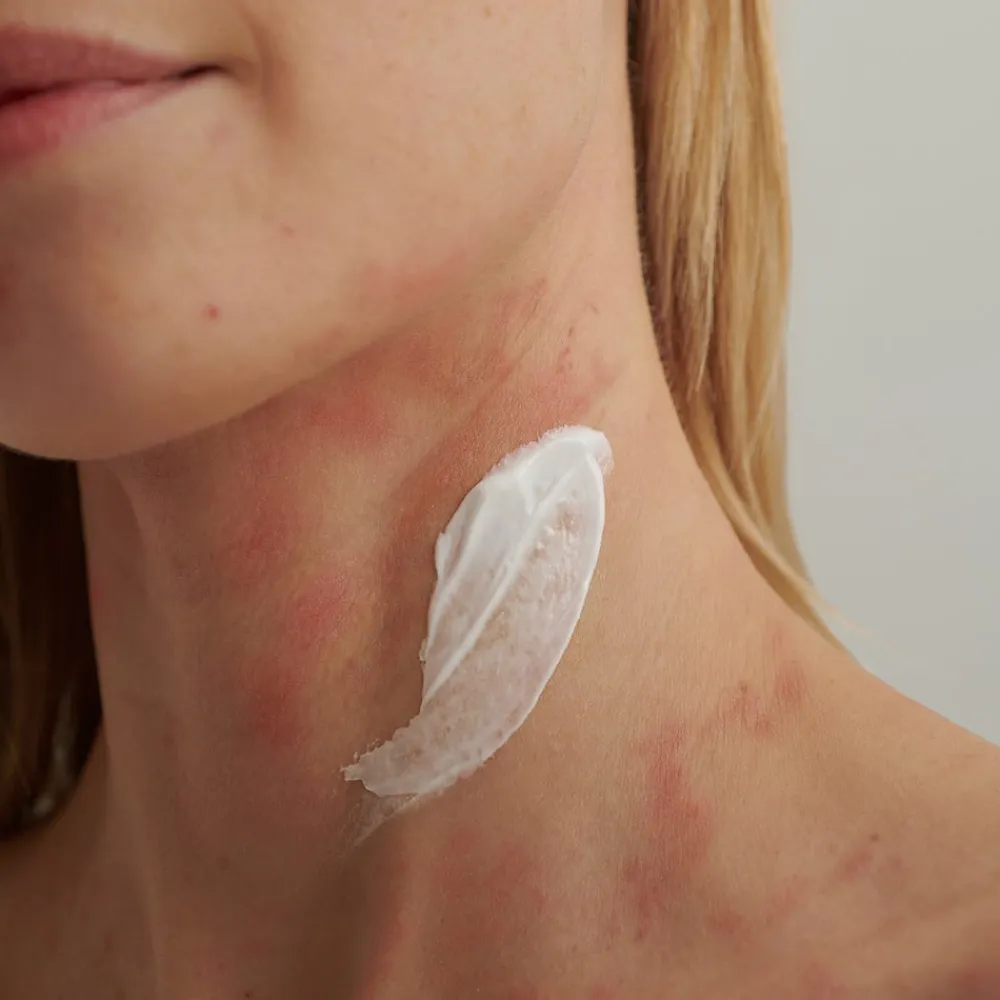 EXTRODERM Intensivcreme 50 ml-Dado Sens Clearance