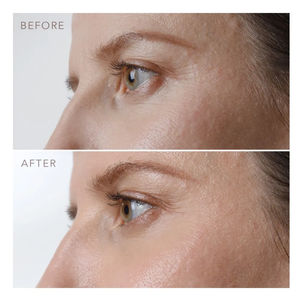 IRIS Firming PM Eye Serum 15 ml-FOREO Sweden Clearance