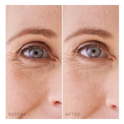 FOREO Sweden Gesicht^IRIS Hydrogel Eye Patches 60 Stück