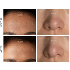 FOREO Sweden Gesicht|KIWI