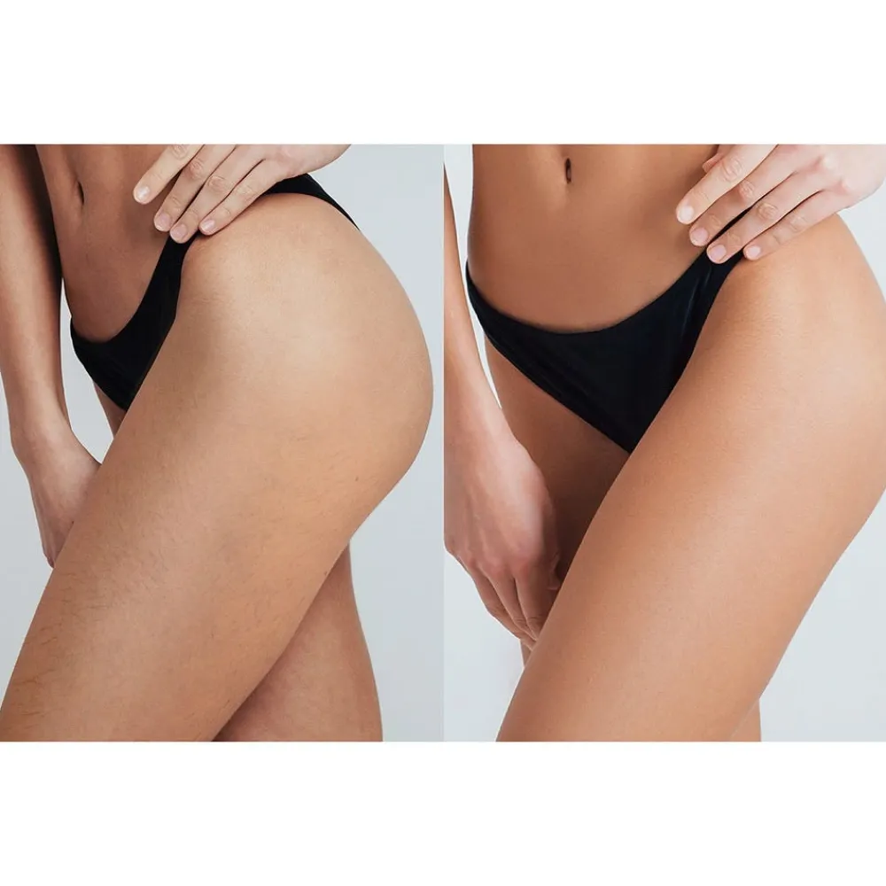 Professionelle IPL-Haarentfernung 2 Pro Max Peach-FOREO Sweden Best