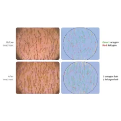 5.25 Leave-In Lotion 100 ml-ICON Online