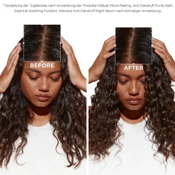 Kerastase Shampoo|Kérastase Symbiose Bain Crème Anti-Pelliculaire 250 ml