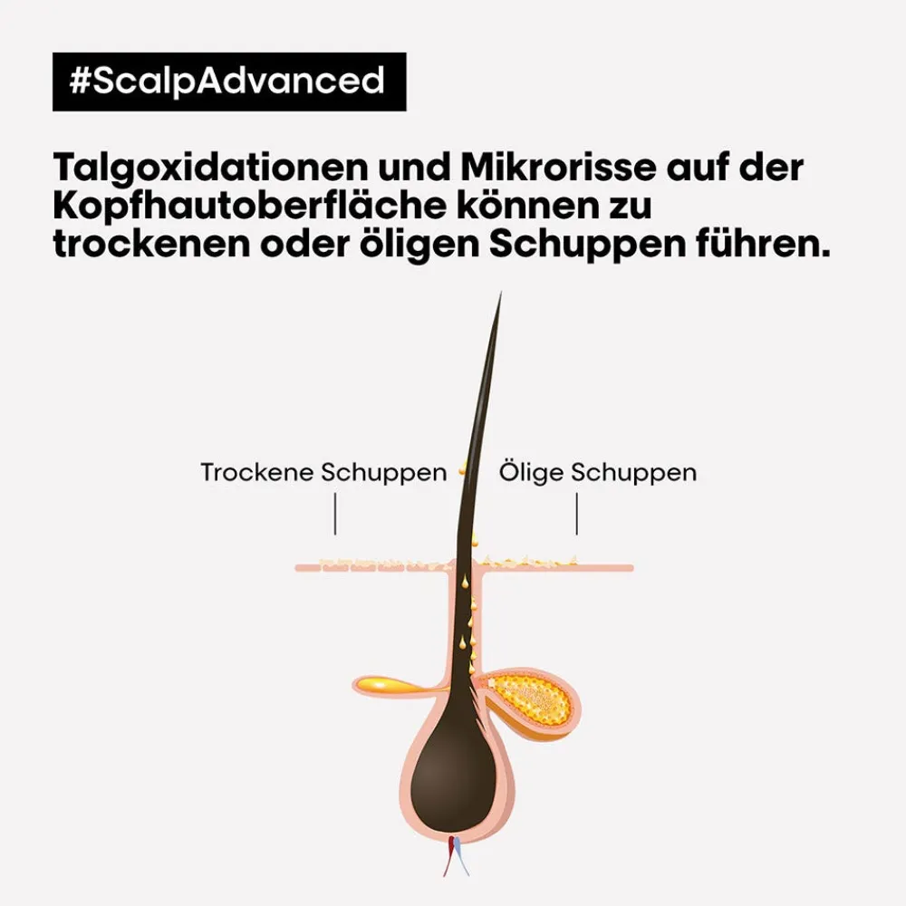 L'Oréal Professionnel Paris Shampoo|Série Expert Scalp Advanced Anti-Dandruff Dermo-Clarifier Shampoo 300 ml