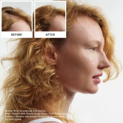 Nioxin Kopfhautpflege|Haarausfall^Scalp + Hair System 1 Conditioner 300 ml