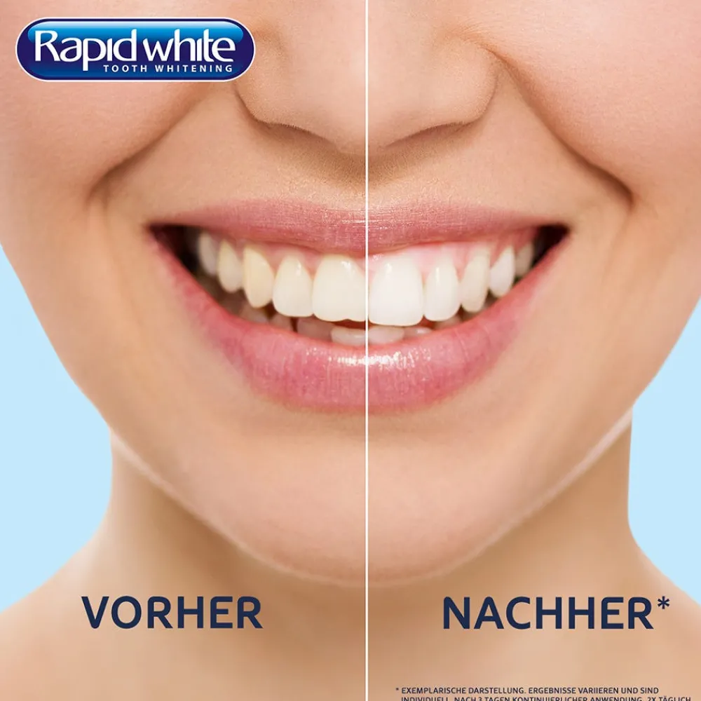 Bleaching Strips-Rapid White Hot