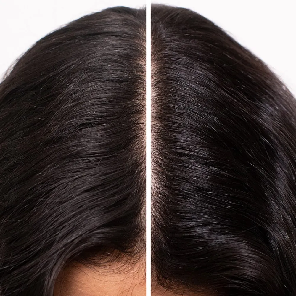 Essence Absolue Kopfhautkonzentrat 50 ml-SHU UEMURA Clearance