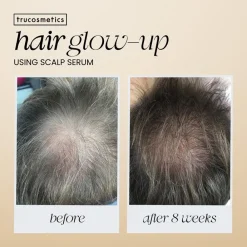 Trucosmetics Hair Growth Serum 50 ml-TRU Cosmetics Discount